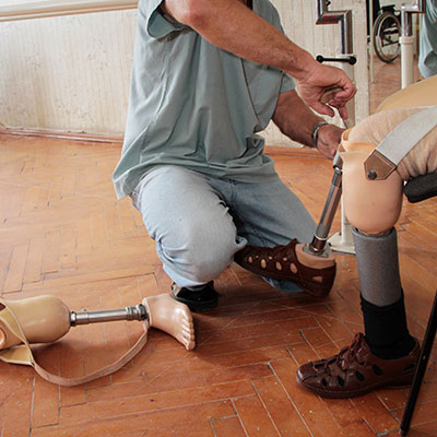 After Amputation Care in the Home After Amputation Care in the Home